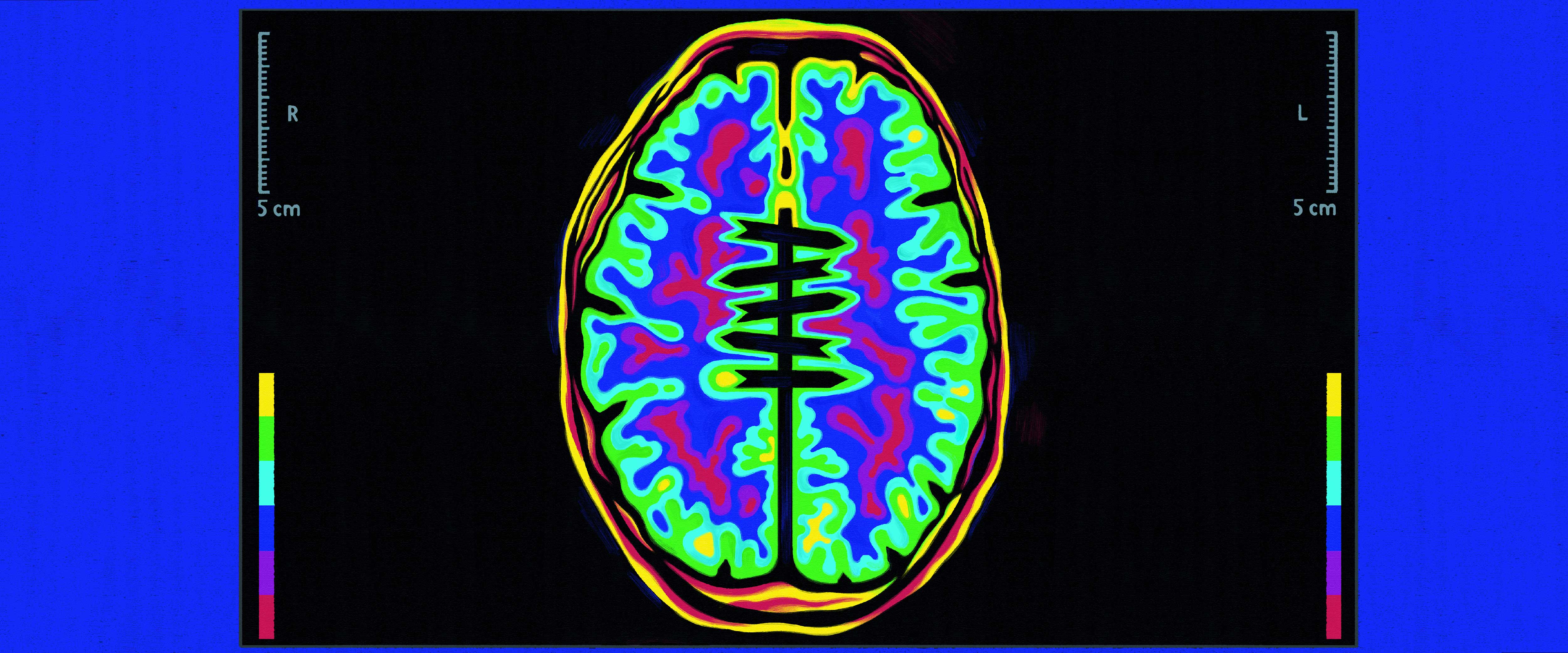 Brain scan
